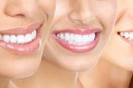 Как ухаживать за коронками