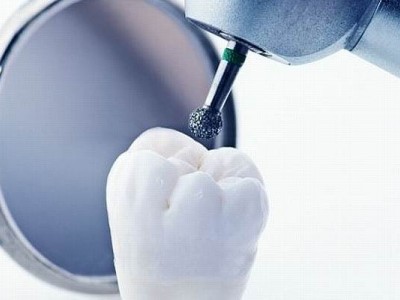 Лечение кариеса зубов