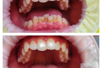 Профессиональная гигиена