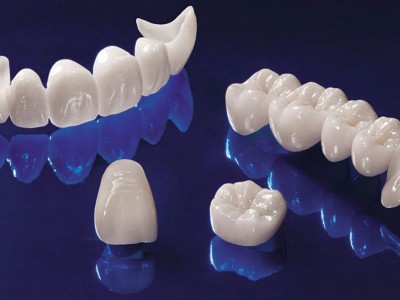 Безметалловые коронки Безметалловые коронки