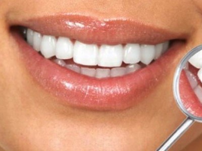 Домашнее отбеливание зубов