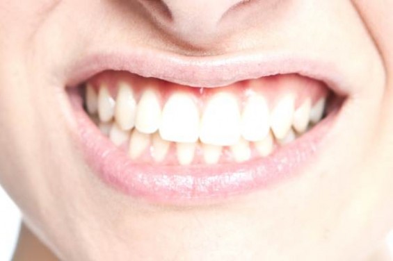 Отбеливание зубов: нюансы процедуры