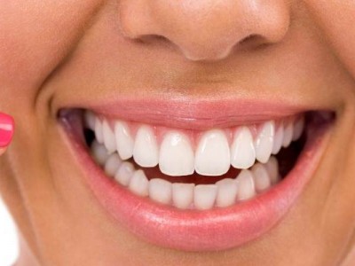 Офисное отбеливание зубов Офисное отбеливание зубов