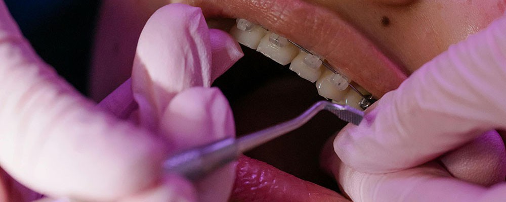 Ортодонтия