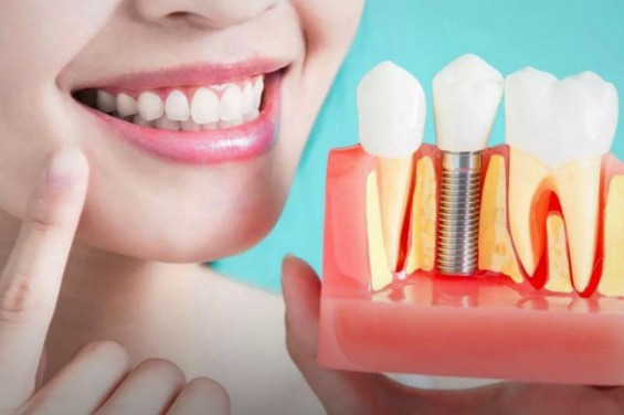 Молодость и красота зависят от состояния зубов